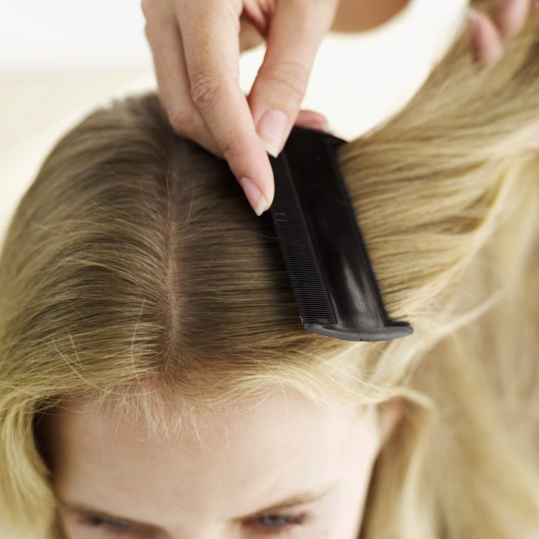 How to Fight Lice & Keep Your Kid’s Head Healthy 8 8570c5adaa5a8173170a607afabb4f4f How to Fight Lice & Keep Your Kid’s Head Healthy - 1