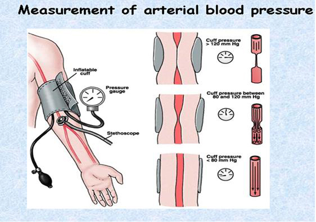 image043 How to Maintain Normal Blood Pressure - 6