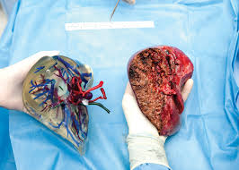 3D Printing Technology at the Service of Health 11 9 1 3D Printing Technology at the Service of Health - 10 3D Printing Technology