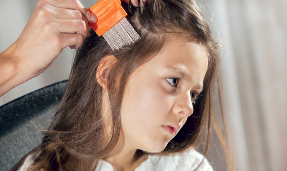 What Do Lice Eggs Look Like on Hair?