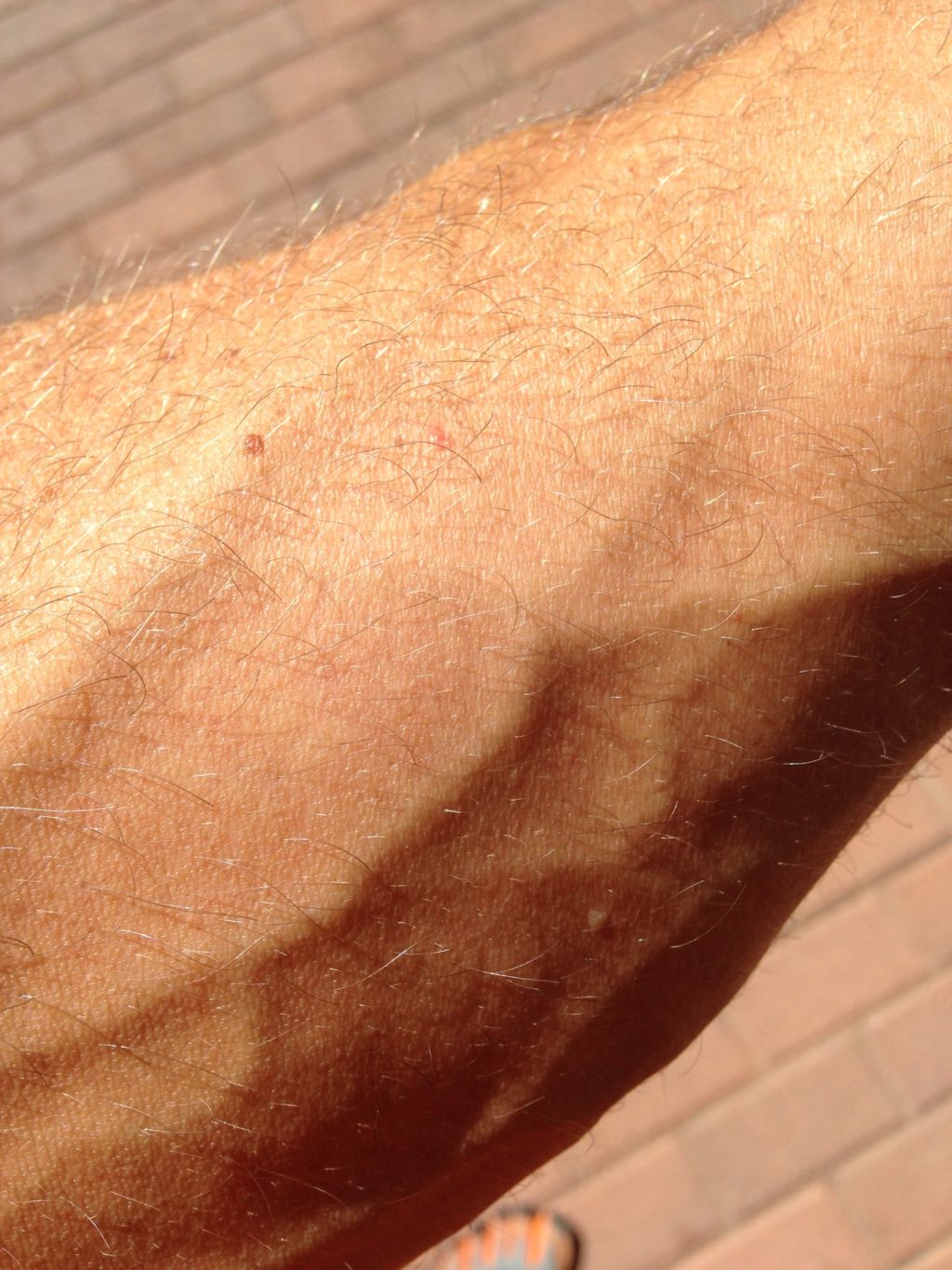 Vitamin D: Symptoms and Warning Signs 4 19 16 1 Vitamin D: Symptoms and Warning Signs - 3 vitamin d symptoms warning signs
