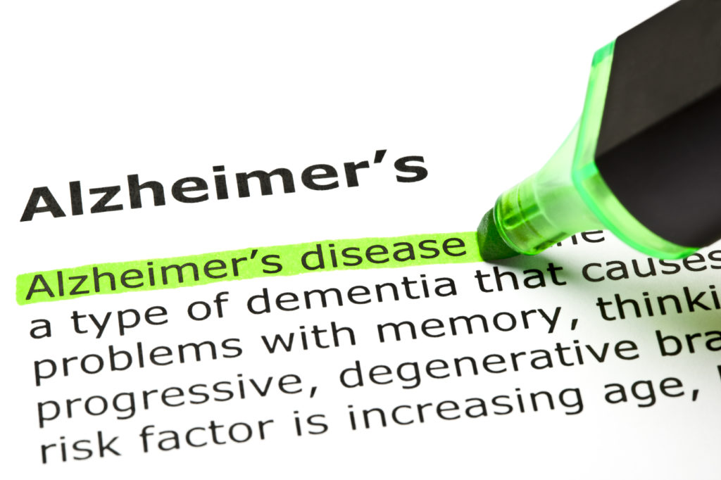 25 1 1 Alzheimer's Disease: Causes, Symptoms and Available Treatments - 2 alzheimer's disease