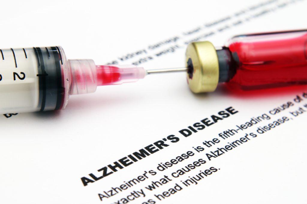 28 1 Alzheimer's Disease: Causes, Symptoms and Available Treatments - 11 alzheimer's disease