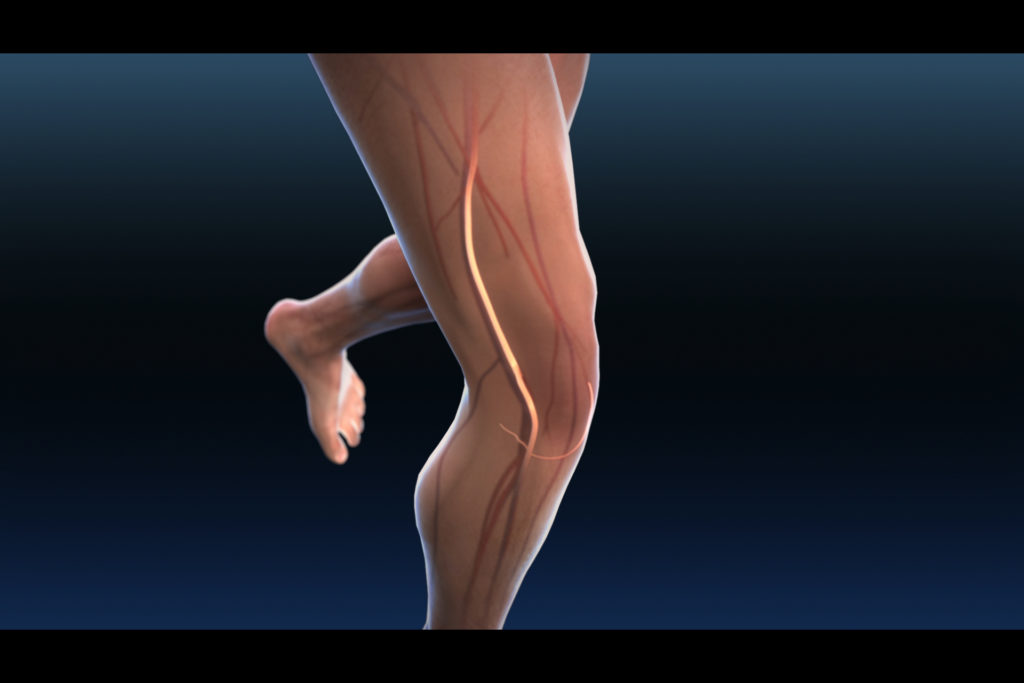 9 19 1 Blocked Arteries: The Main Symptoms and Warning Signs - 8 blocked arteries symptoms