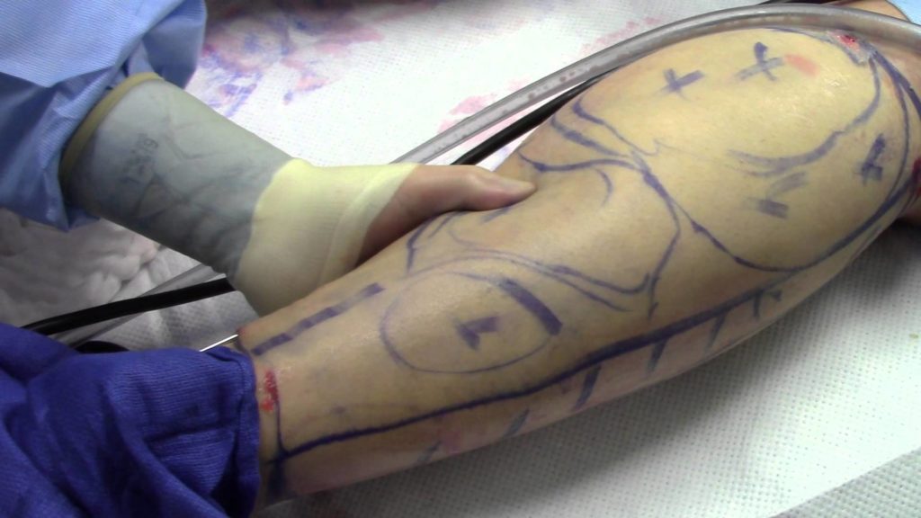 Amazing Science: Top 10 Medical Innovations 7 11 3 1 Amazing Science: Top 10 Medical Innovations - 7 amazing science top 10 medical innovations 2016