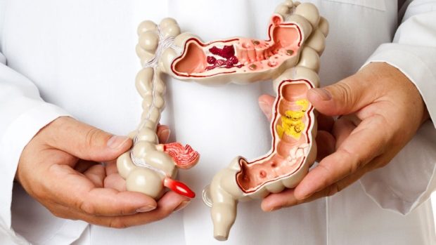 irritable bowel syndrome causes prevention treatments
