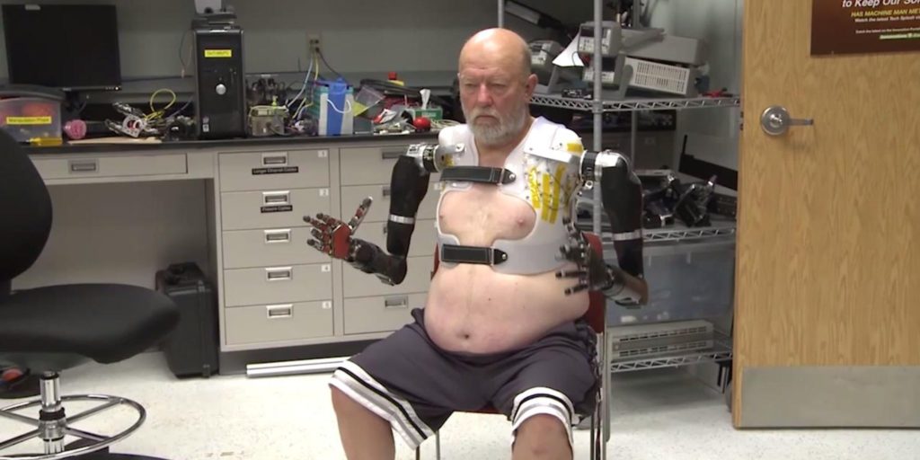 naturally controlled artificial limbs biggest innovation 2016