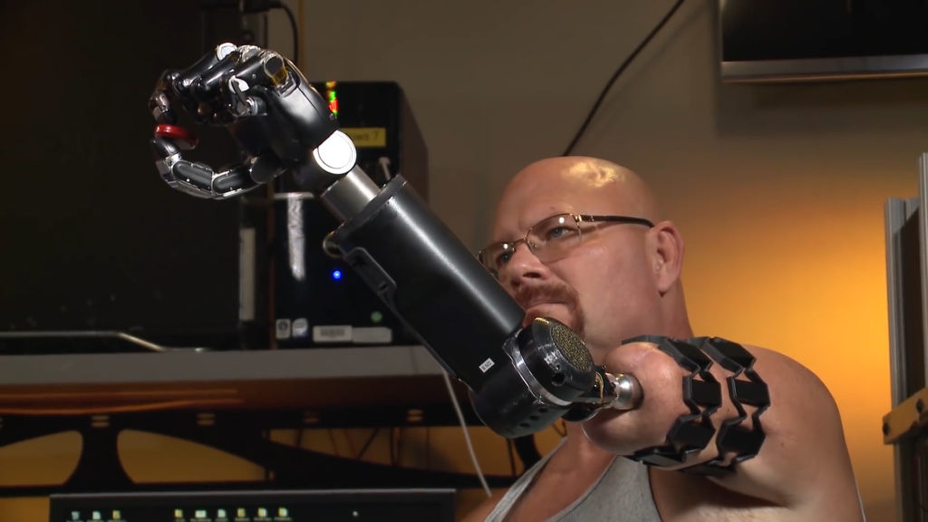 naturally controlled artificial limbs biggest innovation 2016