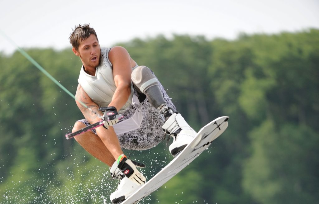 25 5 1 Naturally Controlled Artificial Limbs: the Biggest Innovation - 11 naturally controlled artificial limbs biggest innovation 2016