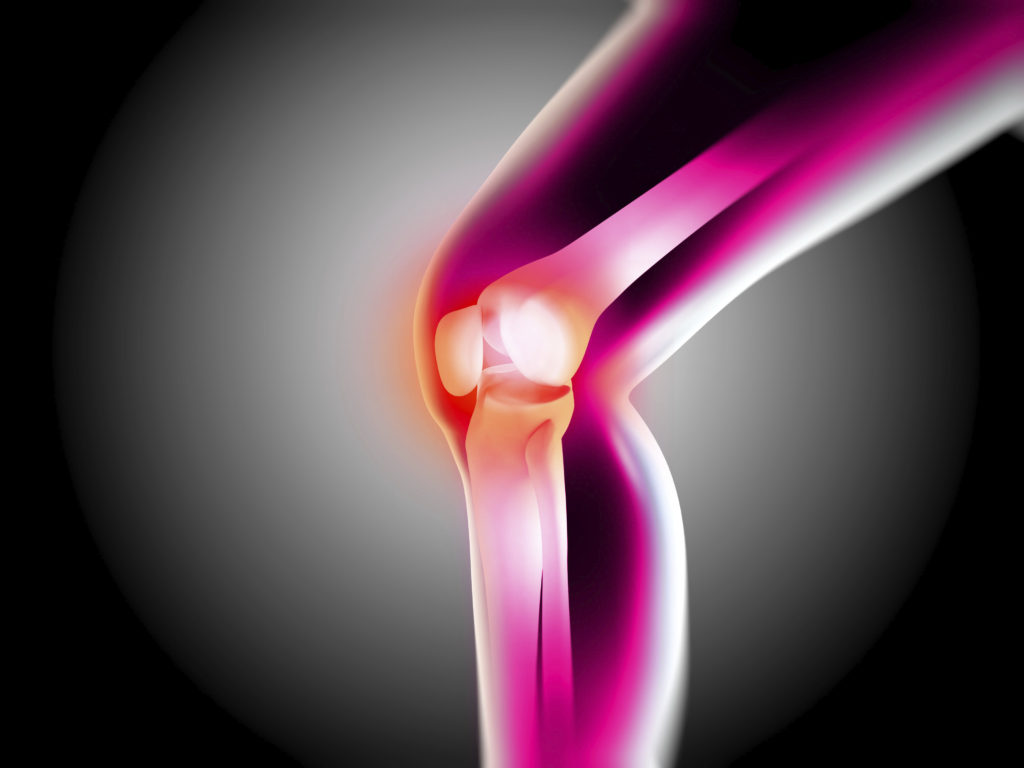 Key Factors that Increase Your Risk of Osteoarthritis 2 5 10 1 Key Factors that Increase Your Risk of Osteoarthritis - 2 key factors increase risk osteoarthritis