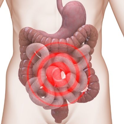 irritable bowel syndrome causes prevention treatments