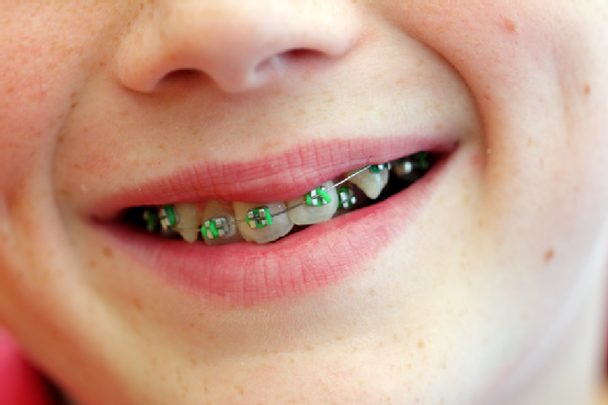 Dental Problems: What Your Teeth Reveal about Your Health 5 teeth problems reaval health