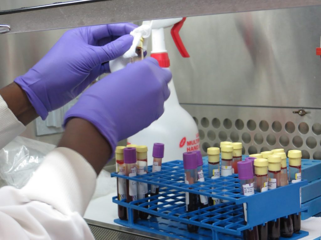 Shingles Viral Infection: Main Causes Finishedand How to Protect Yourself from It 4 vaccine hypertension see lights