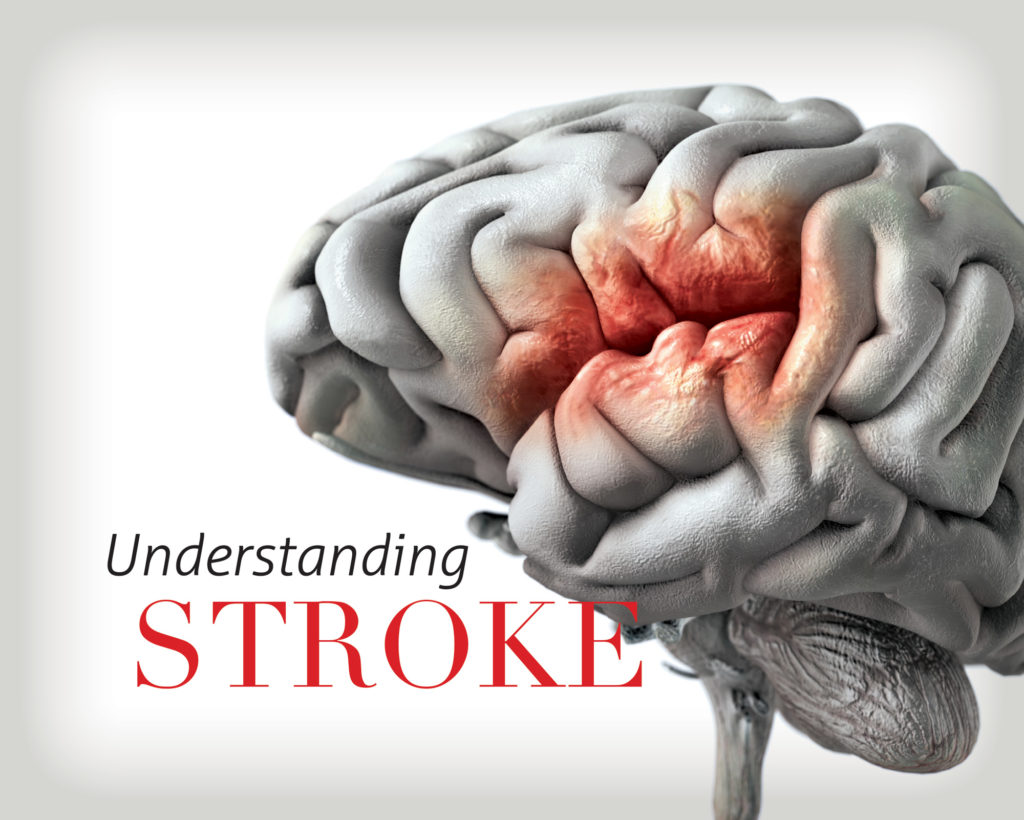 Stroke: Causes, Symptoms, Diagnosis, and Treatment 1 stroke real danger behind serious disease