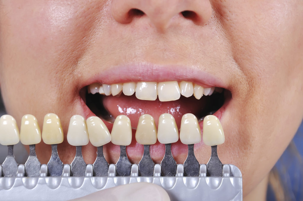 Dental Problems: What Your Teeth Reveal about Your Health 6 teeth problems reaval health