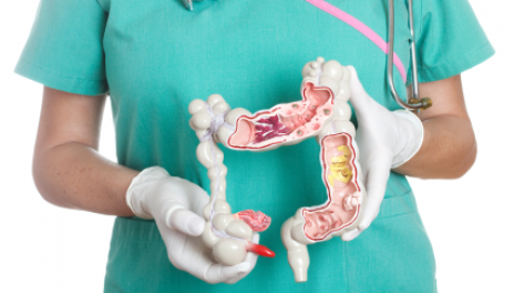 colon cancer description symptoms treatments