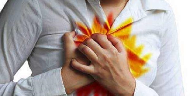 Gastroesophageal Reflux