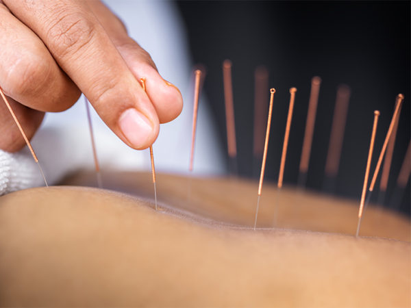 Acupuncture Chi Energy: Chinese Medicine, the Best Known Info and Facts - 1 chi energy