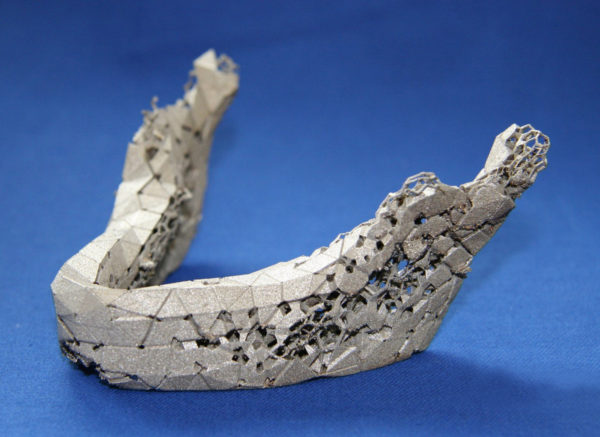 Medical 3D Printing jaws Medical 3D Printing: Top 10 Achievements - 5 Medical 3D Printing