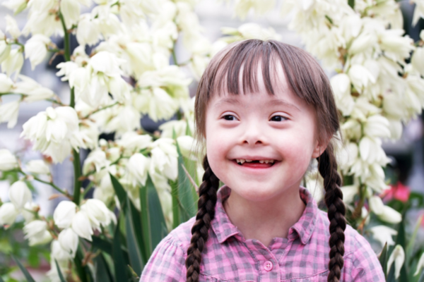 down syndrome Down Syndrome: Trisomy 21 - The Main Causes and People at Risk - 7 Down Syndrome