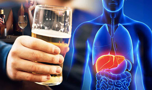 Alcohol and Liver Fatty Liver or "Hepatic Steatosis": Causes and Symptoms - 5 Fatty Liver